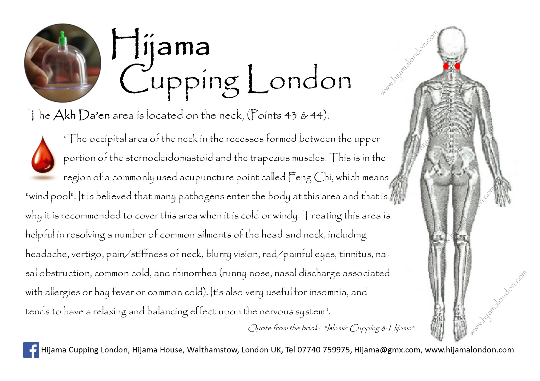 Hijama Cupping Points Chart