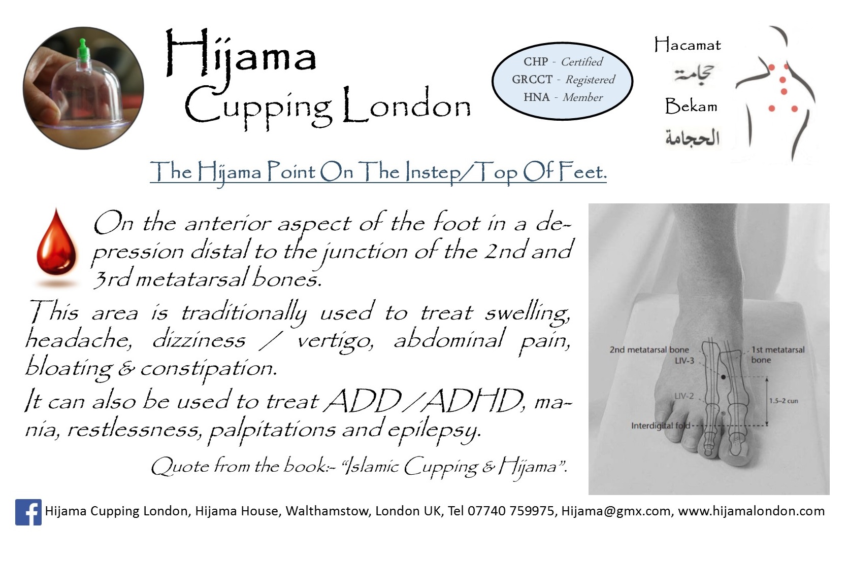 Hijama Cupping Points Chart