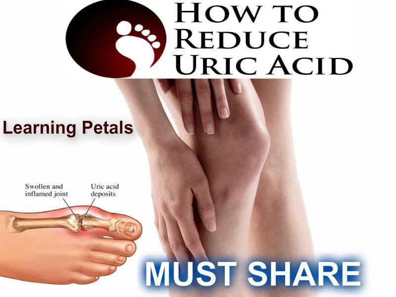 What is a cure for high uric acid levels?