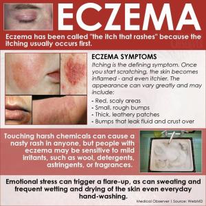 Eczema - Hijama Cupping London