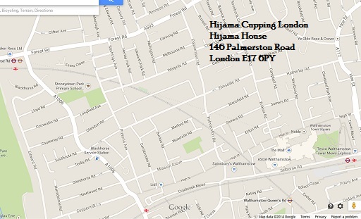Hijama Cupping London Clinic Location Walthamstow London E17